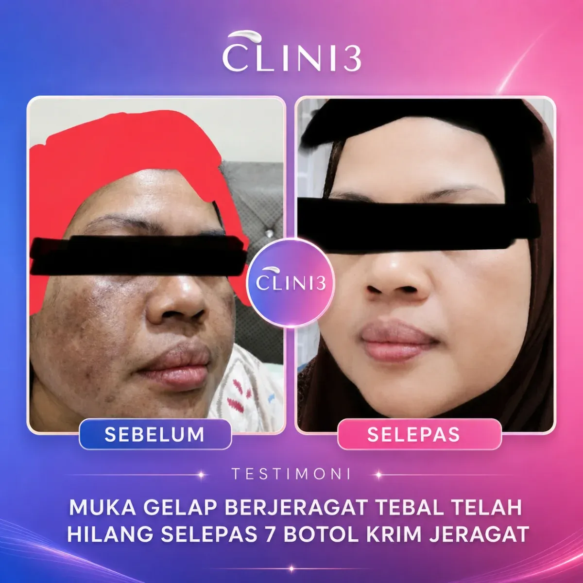 Testimoni Clini3